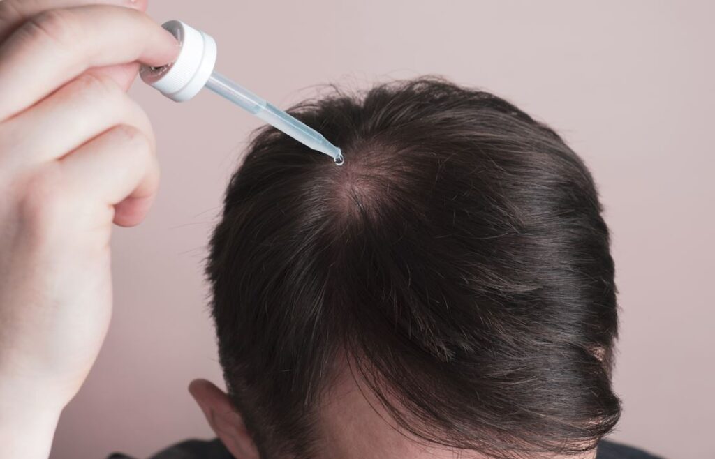 Halcyon Essentials CBD+ AnaGain Hair Loss Treatments